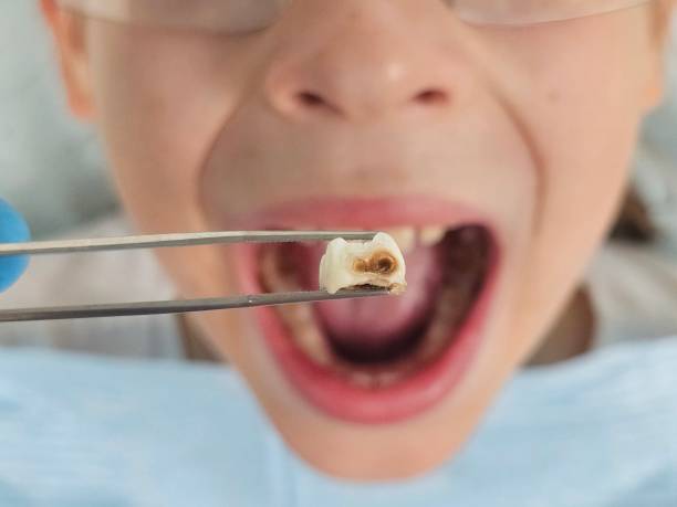 Best Pediatric Emergency Dentist in Eagar, AZ